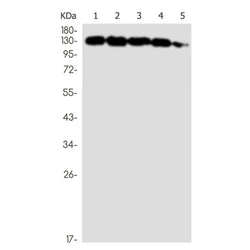 CLTC rabbit monoclonal antibody
