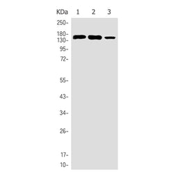 COL3A1 rabbit monoclonal antibody