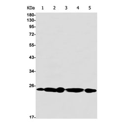 COPS8 rabbit monoclonal antibody