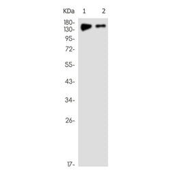 CPS1 rabbit monoclonal antibody