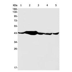 CS rabbit monoclonal antibody
