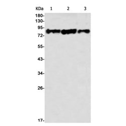 CSDE1 rabbit monoclonal antibody