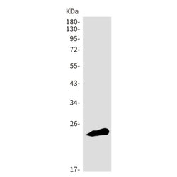 CSHL1 rabbit monoclonal antibody