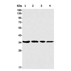 CSNK1A1 rabbit monoclonal antibody