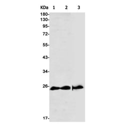 CSNK2B rabbit monoclonal antibody