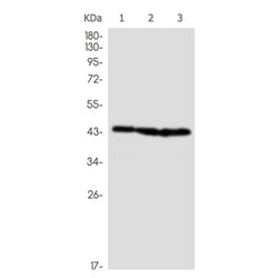 CTH rabbit monoclonal antibody
