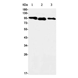 CTNND1 rabbit monoclonal antibody