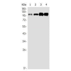 CTNND1 (phospho-Ser268) rabbit monoclonal antibody