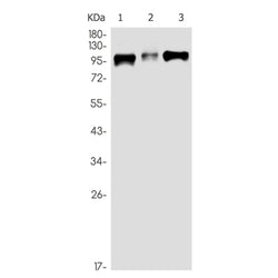 CTNND1 (phospho-Thr916) rabbit monoclonal antibody