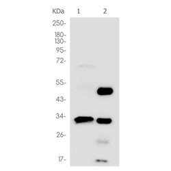 CTSD rabbit monoclonal antibody
