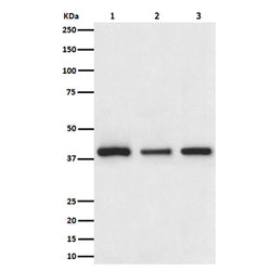 CTSL/CTSV/CTSK/CTSH rabbit monoclonal antibody
