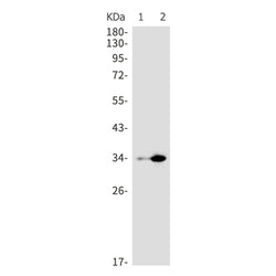 CTSZ rabbit monoclonal antibody