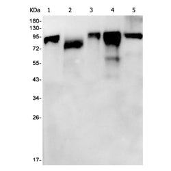 CTTN rabbit monoclonal antibody