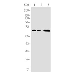 CYBB rabbit monoclonal antibody