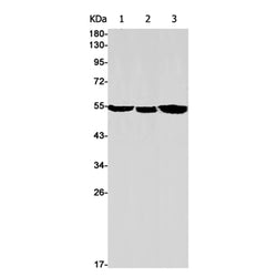 CYP17A1 rabbit monoclonal antibody