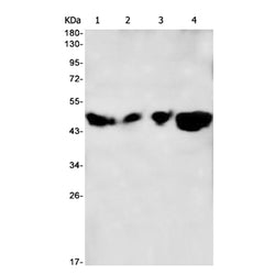 CYP19A1 rabbit monoclonal antibody