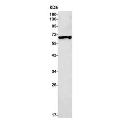 CYP1B1 rabbit monoclonal antibody