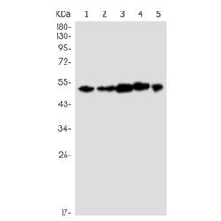 CYP2D6 rabbit monoclonal antibody