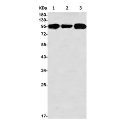 DAB2 rabbit monoclonal antibody