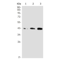 DAG1 rabbit monoclonal antibody