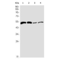 DAPK3 rabbit monoclonal antibody