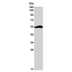 DGAT1 rabbit monoclonal antibody