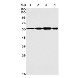DKC1 rabbit monoclonal antibody