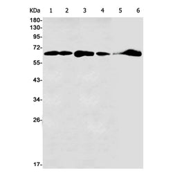 DLAT rabbit monoclonal antibody