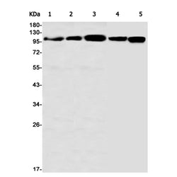 DLG1 rabbit monoclonal antibody