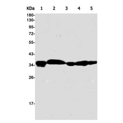 DNAJB6 rabbit monoclonal antibody