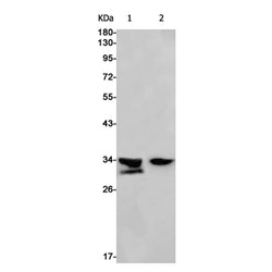 DOHH rabbit monoclonal antibody