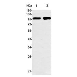 DSC3 rabbit monoclonal antibody