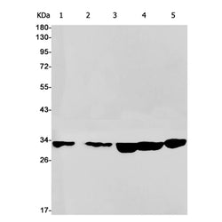ECI1 rabbit monoclonal antibody