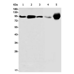 EEF2 rabbit monoclonal antibody