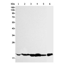 EMC4 rabbit monoclonal antibody