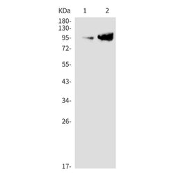 ENG rabbit monoclonal antibody