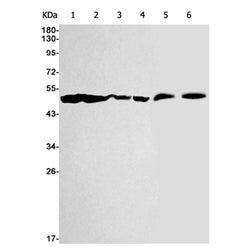 ENO1 rabbit monoclonal antibody