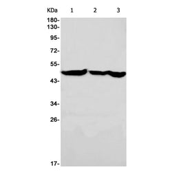 ENO1/ENO2/ENO3 rabbit monoclonal antibody