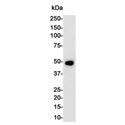ENO2 rabbit monoclonal antibody