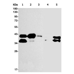 EPCAM rabbit monoclonal antibody