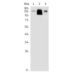 EPHB1 rabbit monoclonal antibody