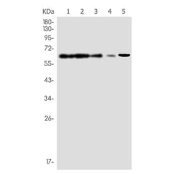 EPHX2 rabbit monoclonal antibody