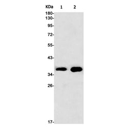 ERCC1 rabbit monoclonal antibody