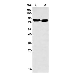 ERCC2 rabbit monoclonal antibody