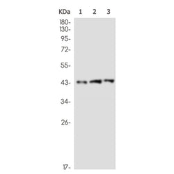ERCC8 rabbit monoclonal antibody
