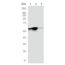 ESR2 rabbit monoclonal antibody