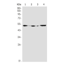 ETS1 rabbit monoclonal antibody