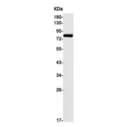 EWSR1 rabbit monoclonal antibody