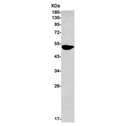 FADS1 rabbit monoclonal antibody