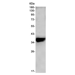 FAM98B rabbit monoclonal antibody